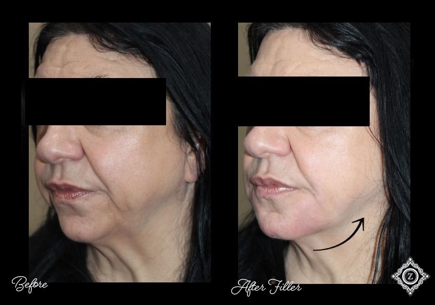 Z Aesthetic Dermatology in Baton Rouge & Prairieville