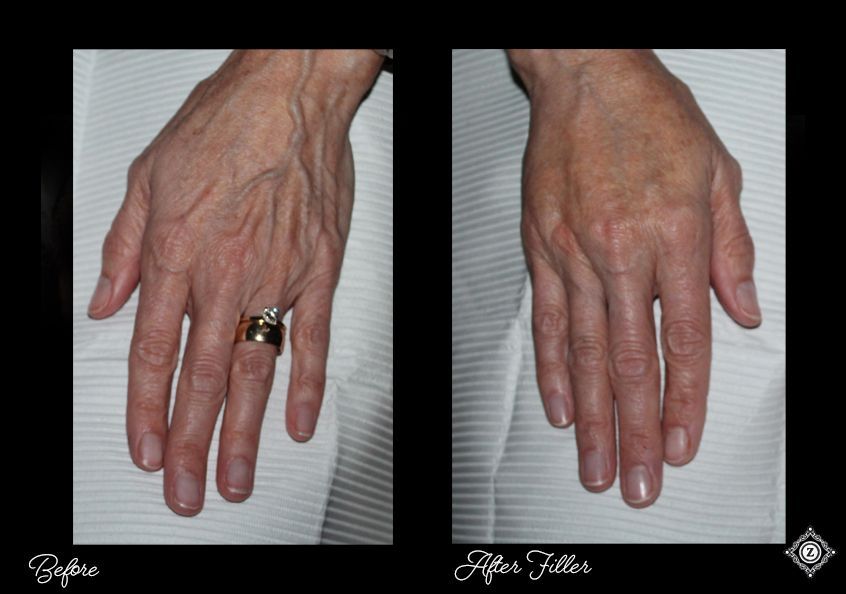 Z Aesthetic Dermatology in Baton Rouge & Prairieville