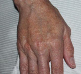 A close up of a person 's hand with a white shirt in the background