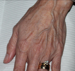 A close up of a person 's hand with a ring on it