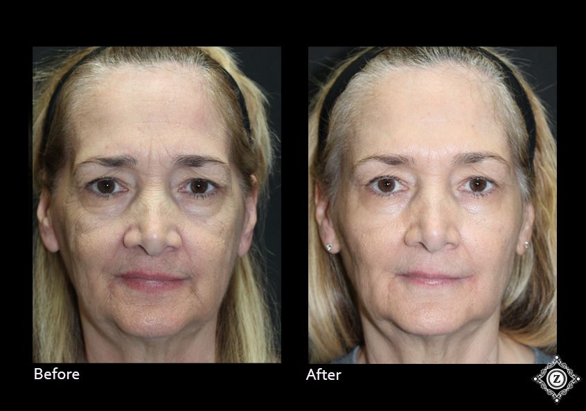 Z Aesthetic Dermatology in Baton Rouge & Prairieville