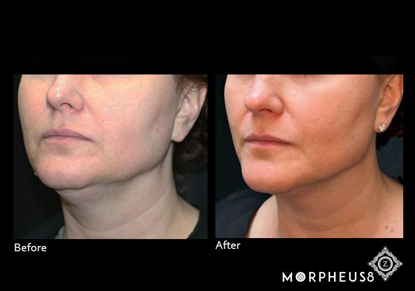 Z Aesthetic Dermatology in Baton Rouge & Prairieville