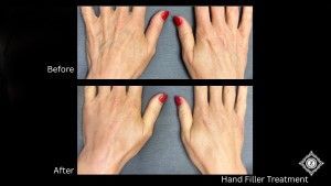 Z Aesthetic Dermatology in Baton Rouge & Prairieville