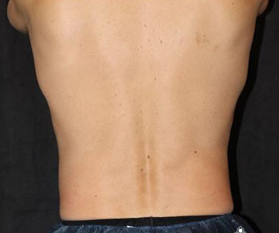 A close up of a person 's back with a black background.