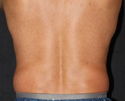 A close up of a man 's back with a black background.