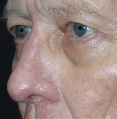 A close up of a man 's face with blue eyes.