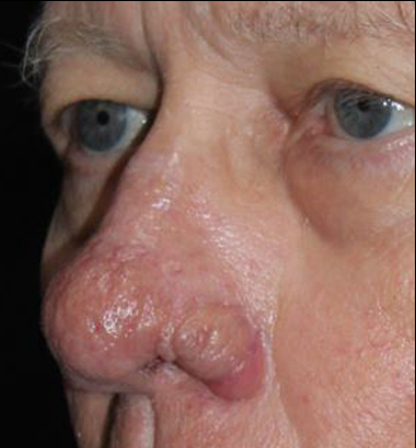 A close up of a man 's nose and eyes