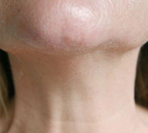 A close up of a woman 's neck and face.