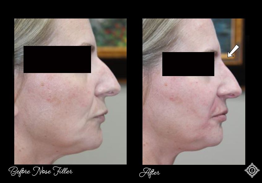 Z Aesthetic Dermatology in Baton Rouge & Prairieville