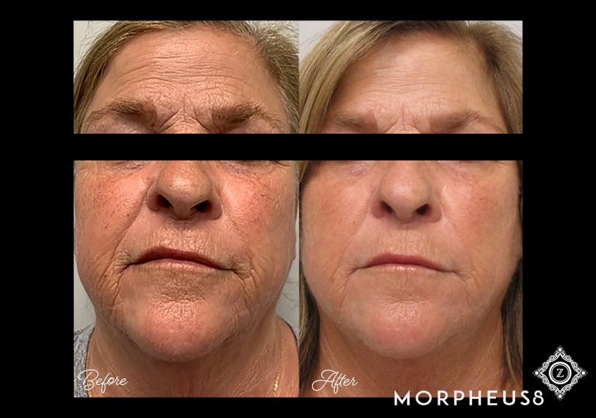 Z Aesthetic Dermatology in Baton Rouge & Prairieville