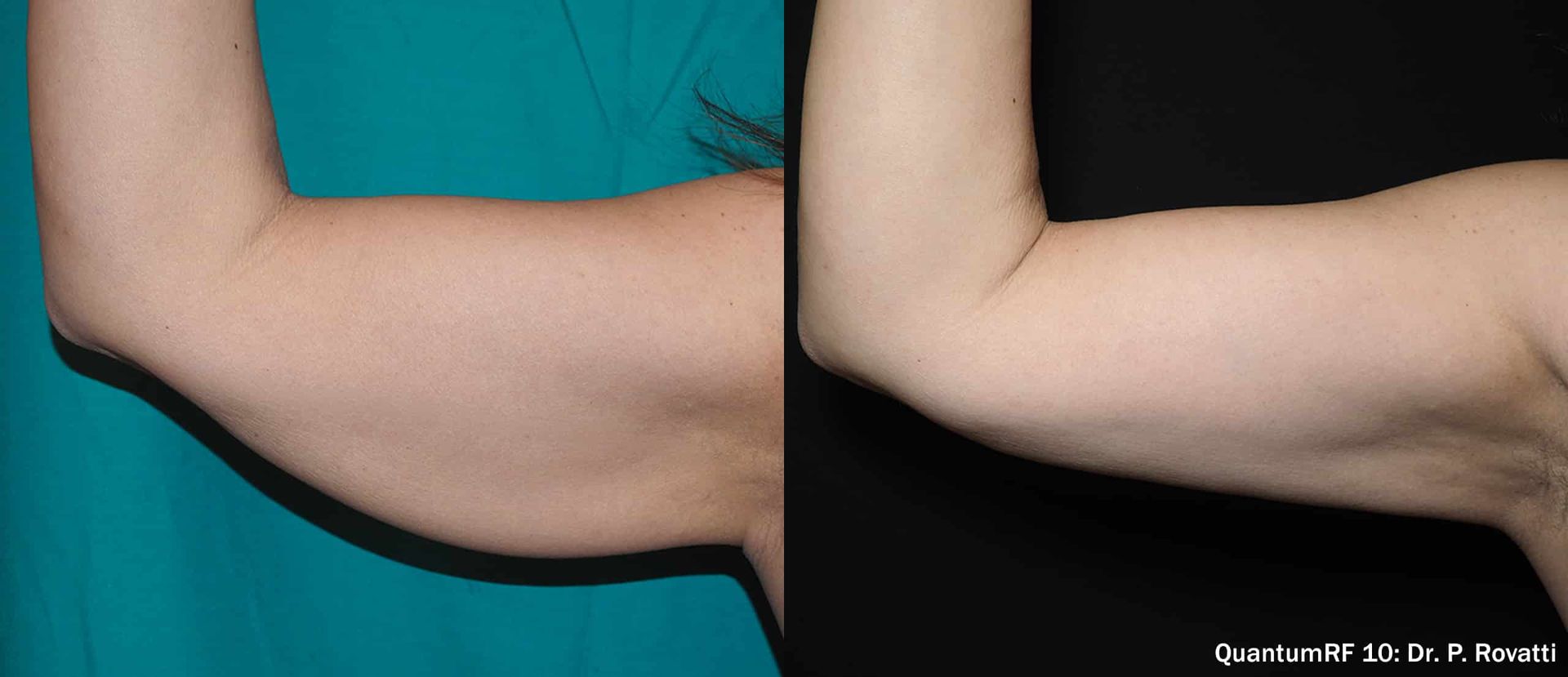 Z Aesthetic Dermatology in Baton Rouge & Prairieville