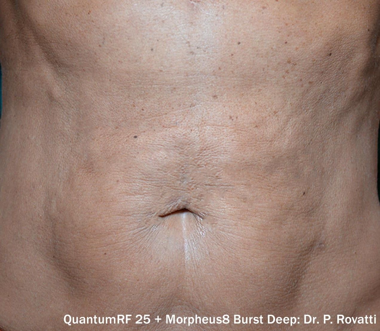 Z Aesthetic Dermatology in Baton Rouge & Prairieville