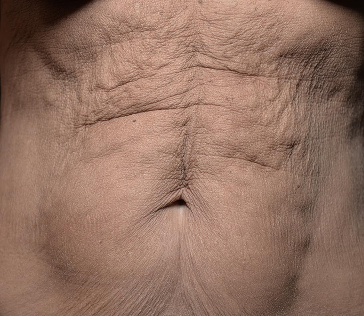 Z Aesthetic Dermatology in Baton Rouge & Prairieville