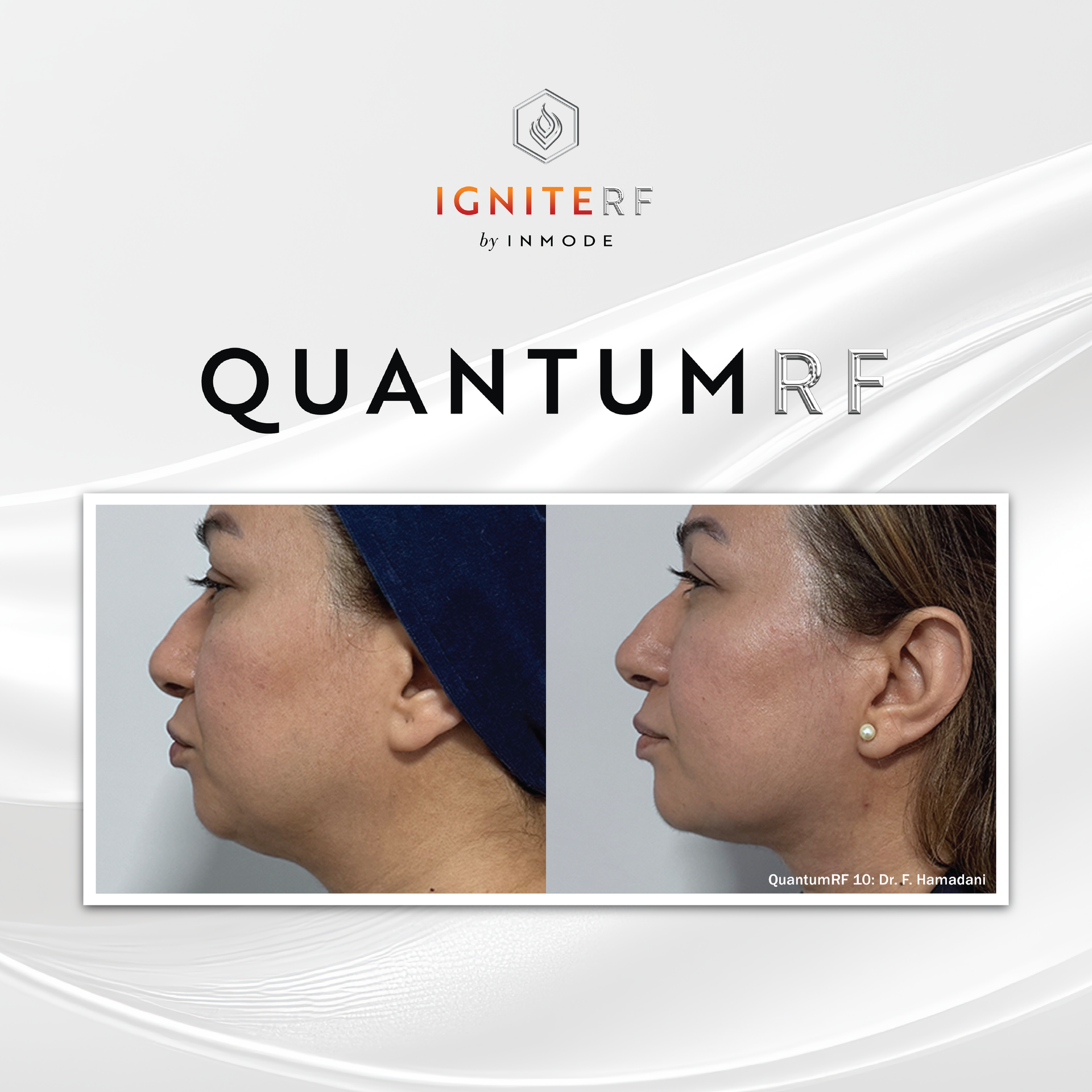 Z Aesthetic Dermatology in Baton Rouge & Prairieville