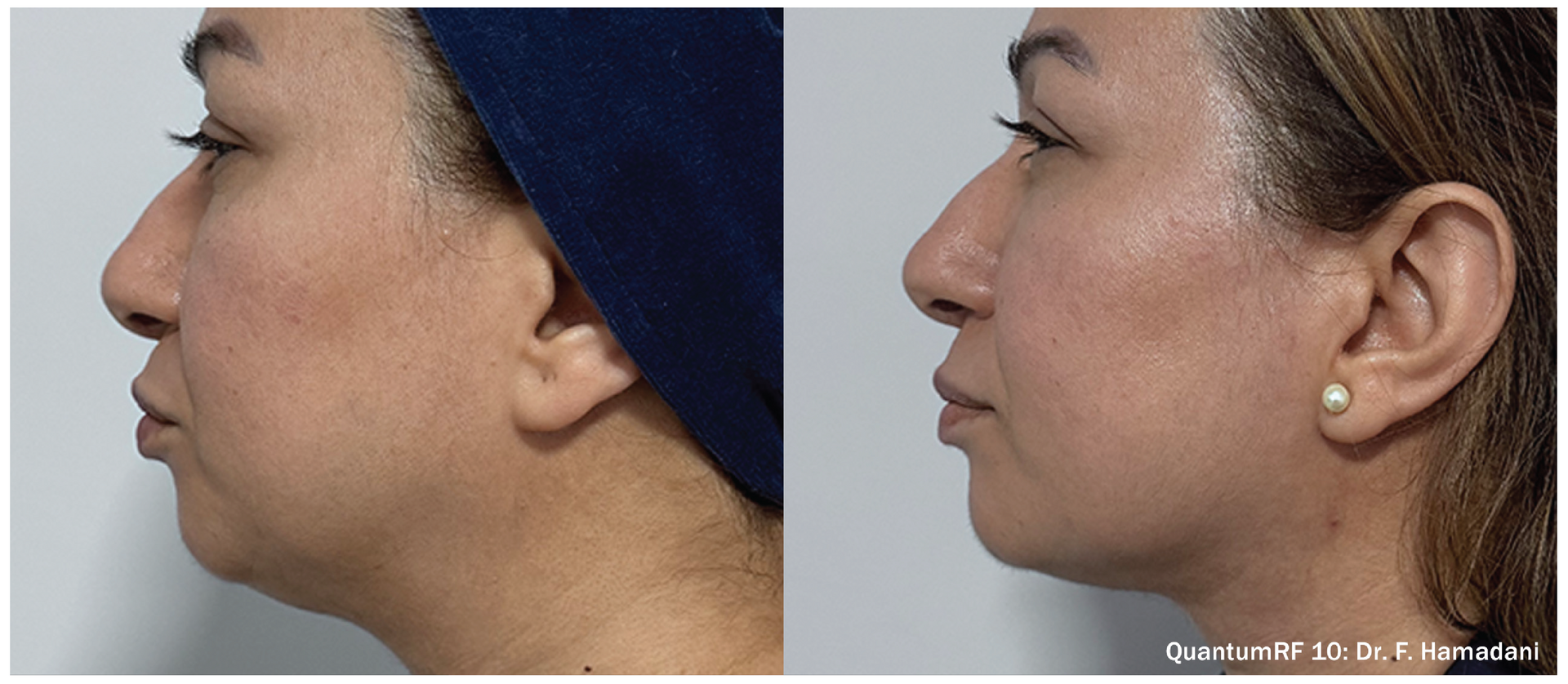 Z Aesthetic Dermatology in Baton Rouge & Prairieville