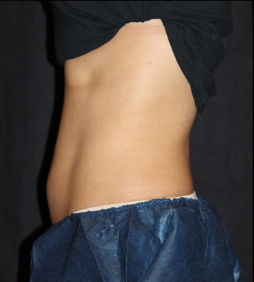 A woman 's stomach is shown in a black shirt and blue shorts