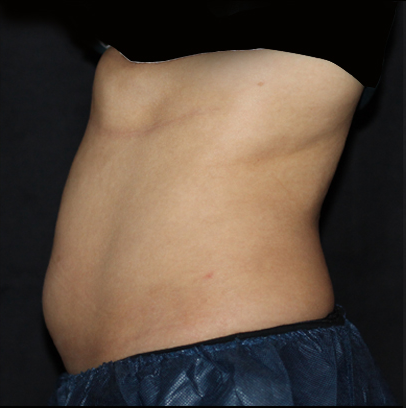 A woman 's stomach is shown with a black background