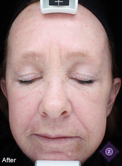 A close up of a woman 's face with her eyes closed