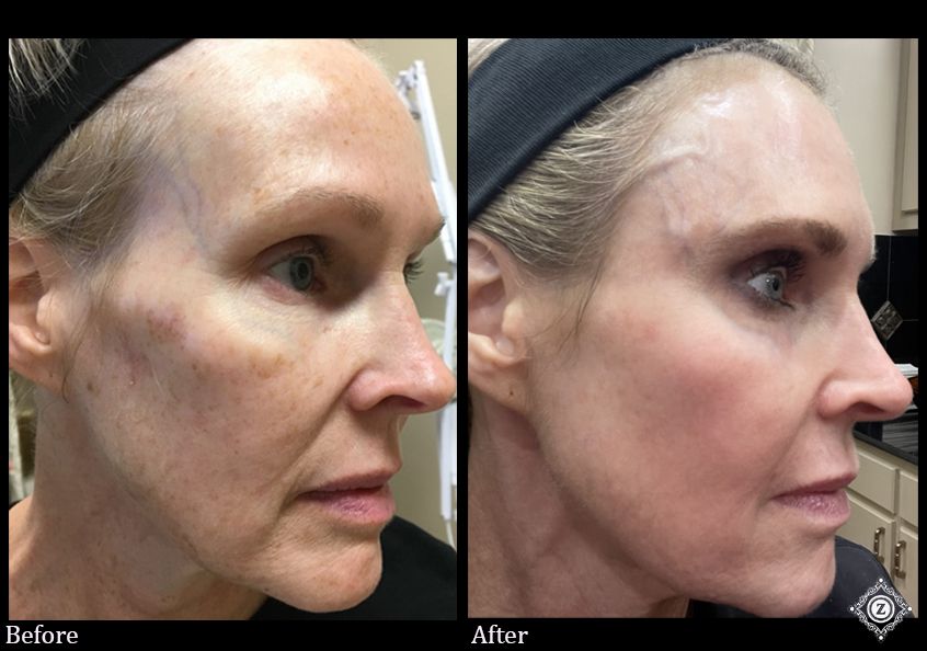 Z Aesthetic Dermatology in Baton Rouge & Prairieville