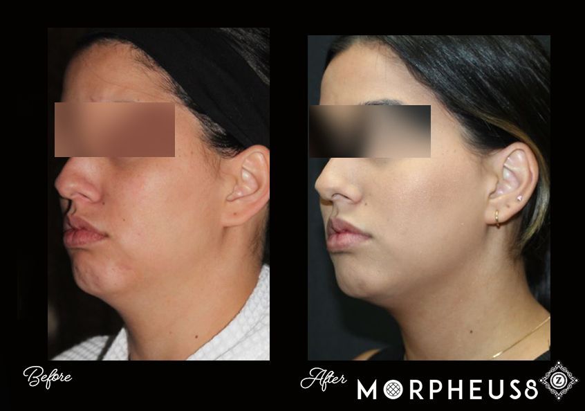 Z Aesthetic Dermatology in Baton Rouge & Prairieville