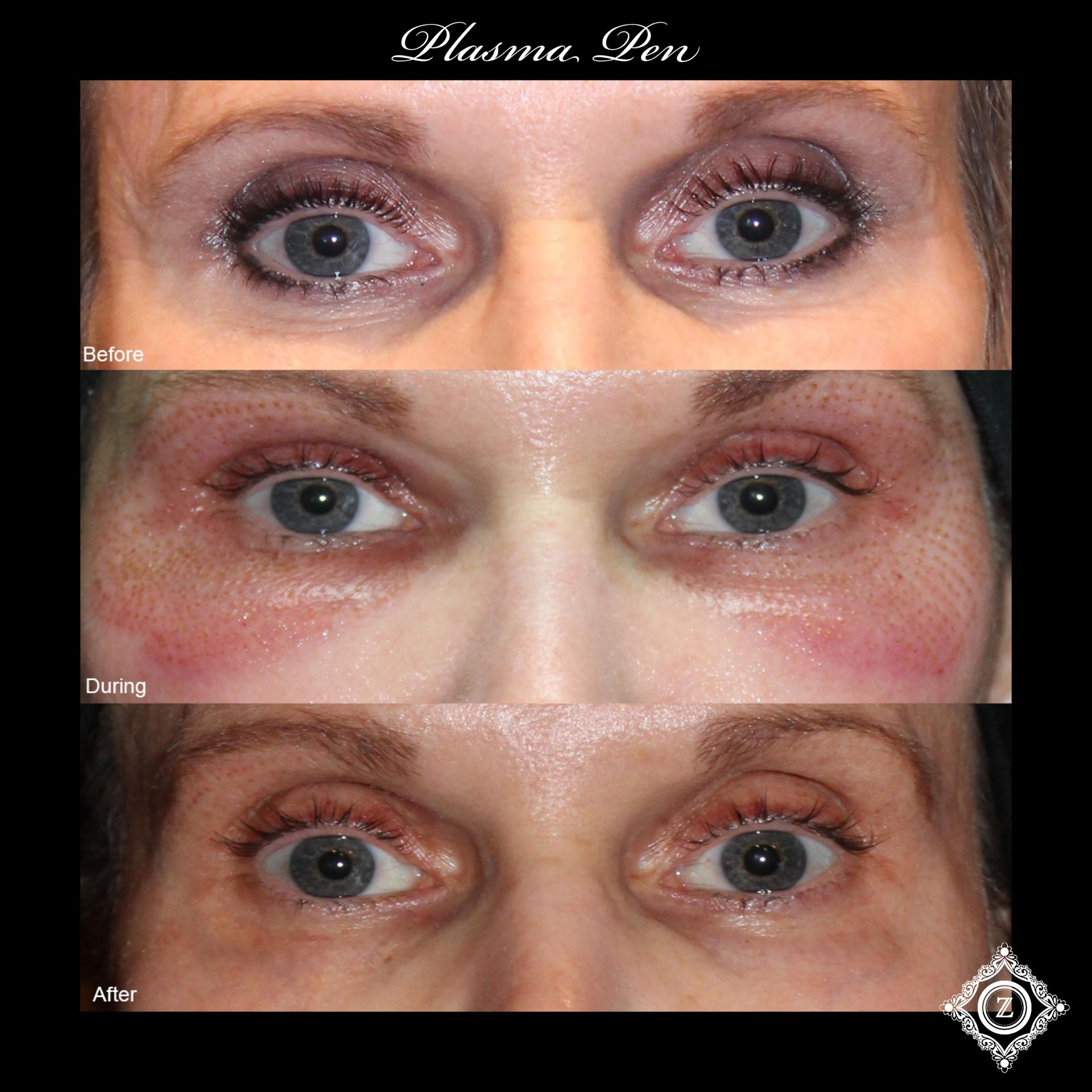 Z Aesthetic Dermatology in Baton Rouge & Prairieville