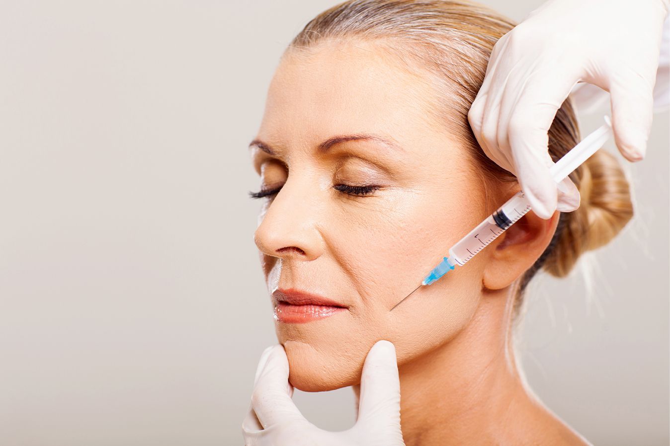 Radiesse for Cheeks & Mid-Face Volume Restoration Treatment in Baton Rouge