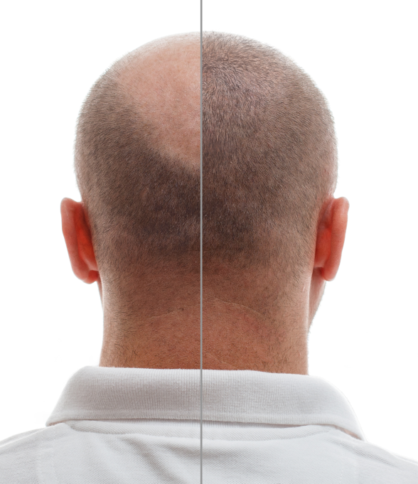 Antes e Depois Antes e Depois