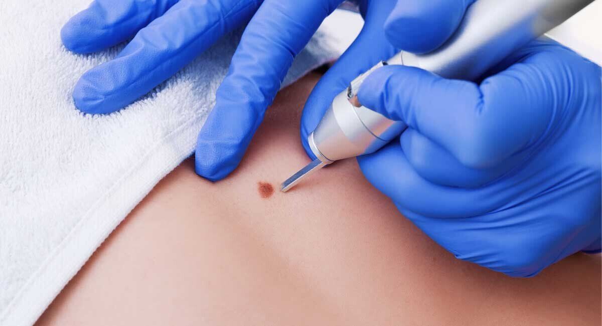 Home Advanced Skin Clinic & Surgery Upland, CA