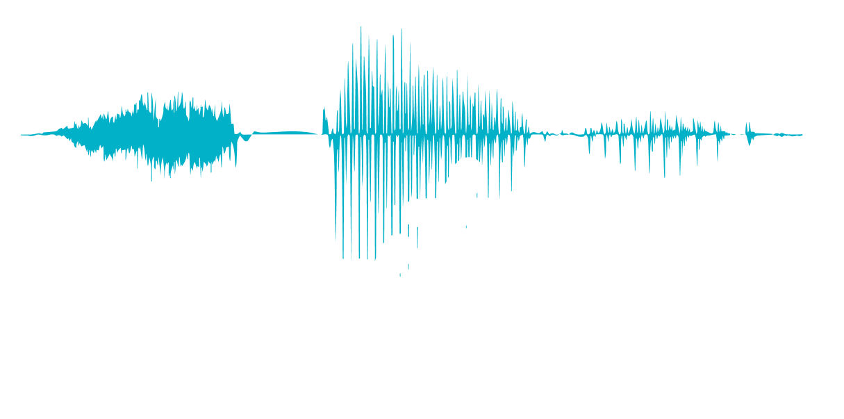 A teal sound wave graphic showing three distinct segments of varying amplitude and density against a white background.