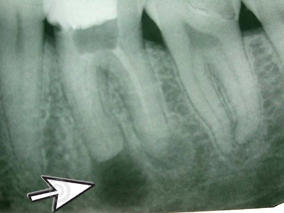 Radiografia dentale 1