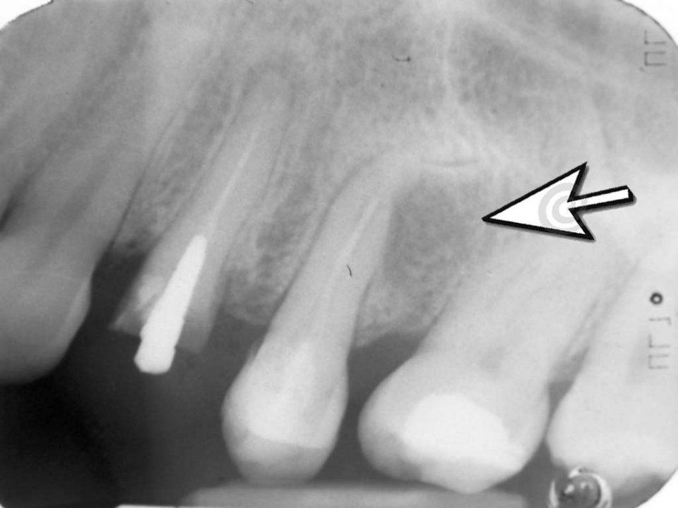 Dental radiography before