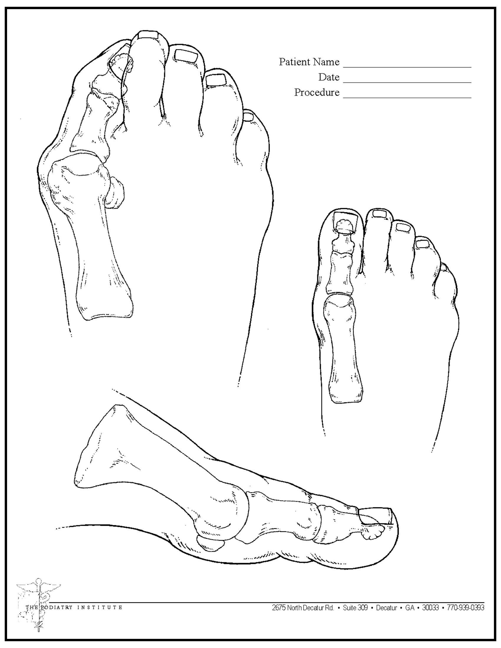 A line drawing of a human foot from top, side, and front angles, with space at the top to record patient information.