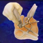 A surgical illustration showing a gloved hand using a bone saw on a piece of bone held by forceps and clamps.
