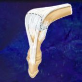 An anatomical illustration showing a finger joint with an injury to the extensor tendon and a surgical dashed cut line.