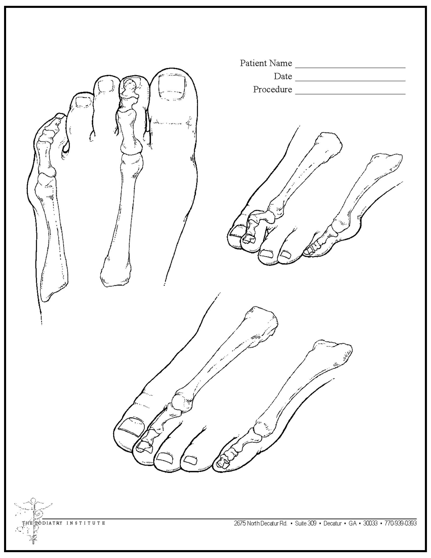 Line drawings of human foot bones from multiple angles on a medical form template with blanks for patient information.