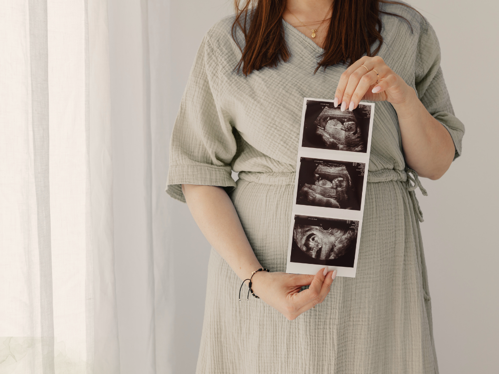 Pregnant person in a gray dress holding ultrasound printouts in front of their torso