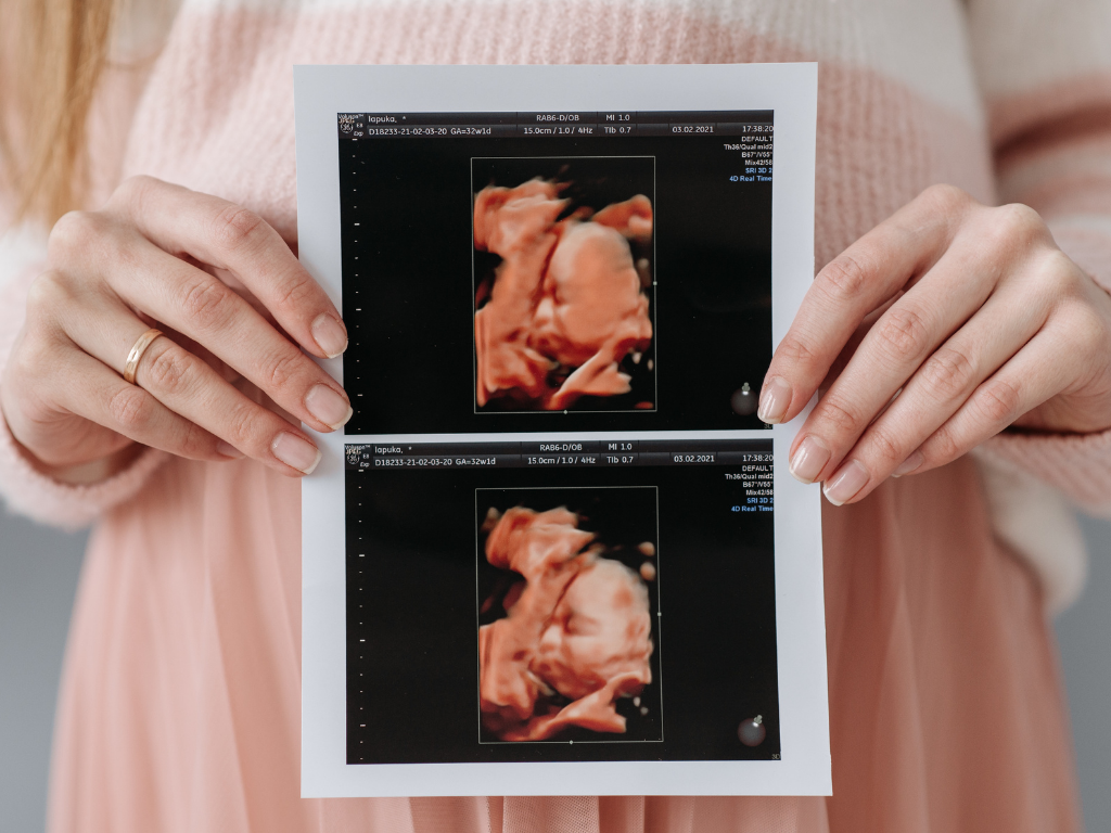 Hands holding two ultrasound scan prints against a pink shirt background