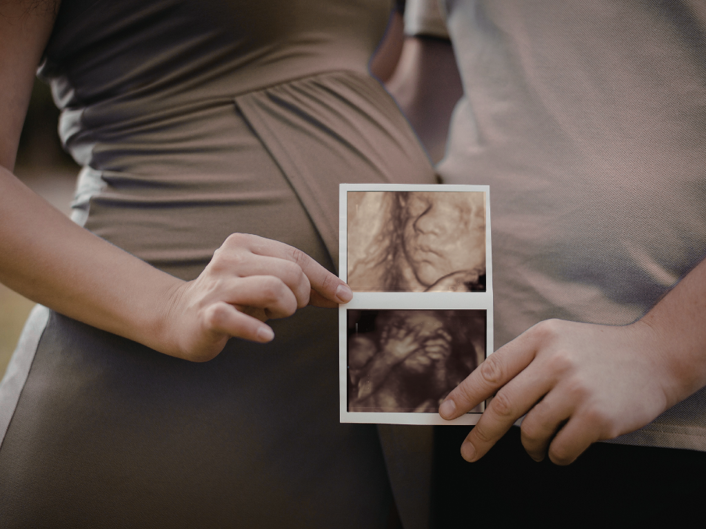 Hands holding a pair of ultrasound scans over a pregnant belly