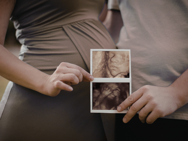 Hands holding a pair of ultrasound scans over a pregnant belly
