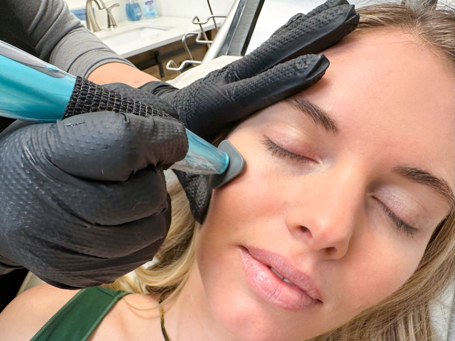 A person receiving a facial treatment. A gloved hand uses a blue device on their cheek.