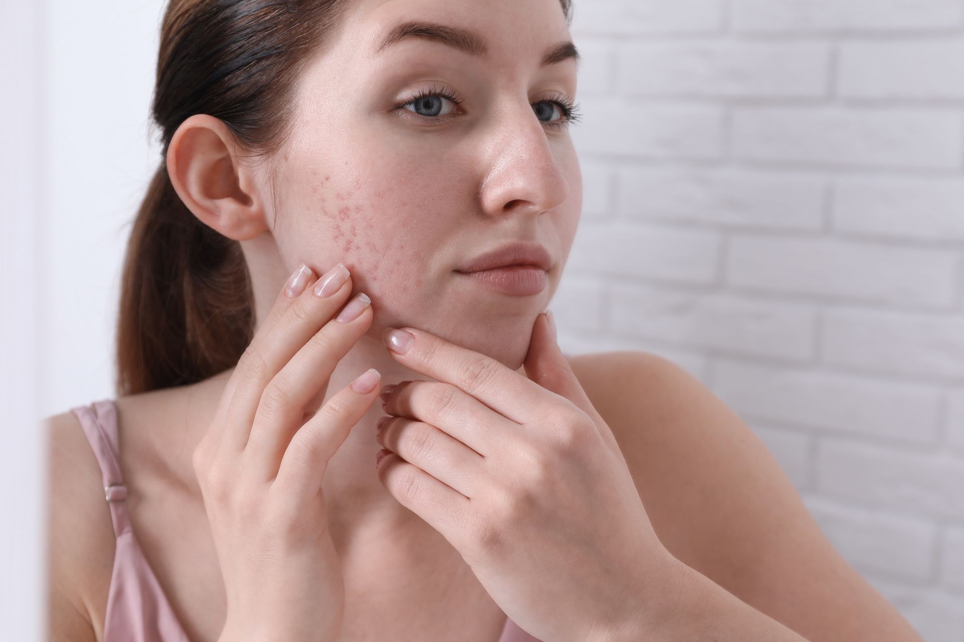 Woman looking in mirror at her face, touching her cheek with acne, by a white brick wall.