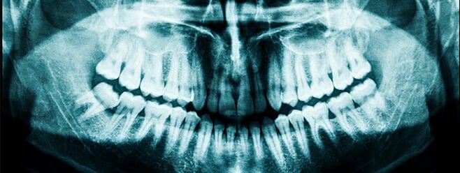 X-ray atm — Oral & Maxillofacial Pathology & Surgery Dentists in Tucson, AZ