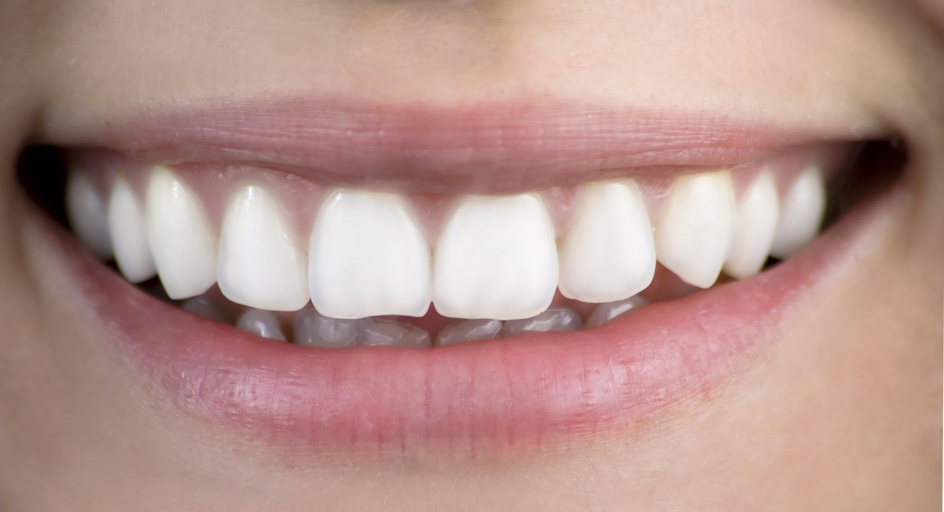 White teeth — Jackson, MS — Central MS OMS