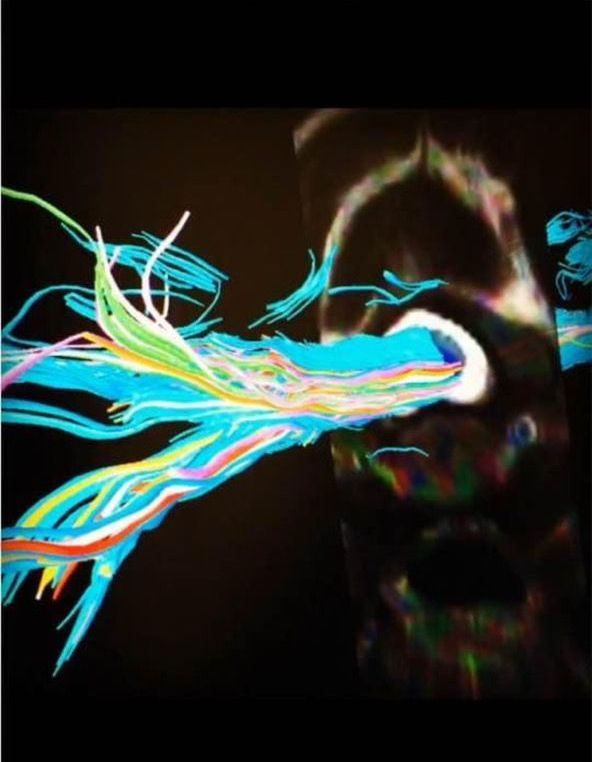 A phone screen with a picture of a jellyfish on it