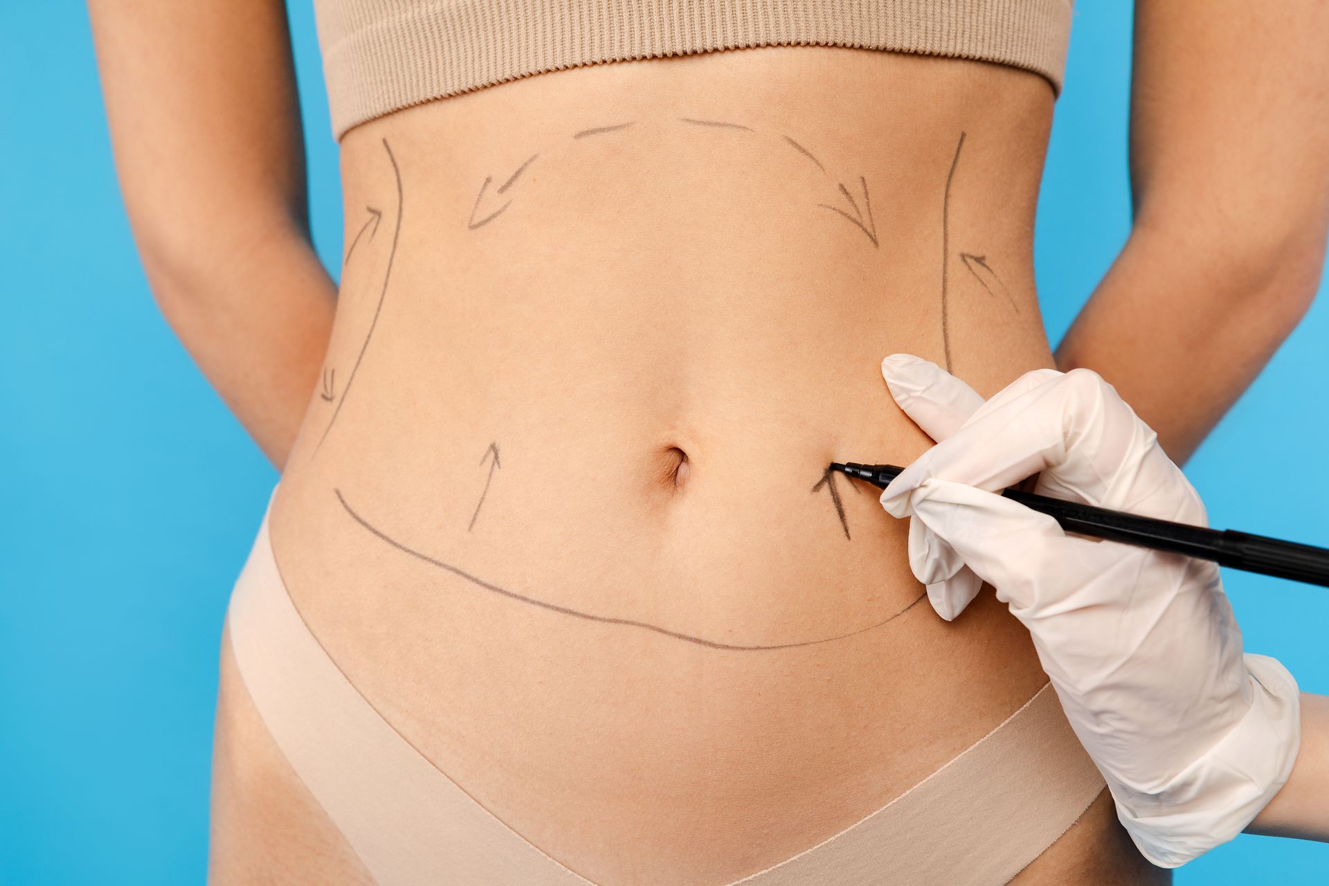 Facelift Procedure