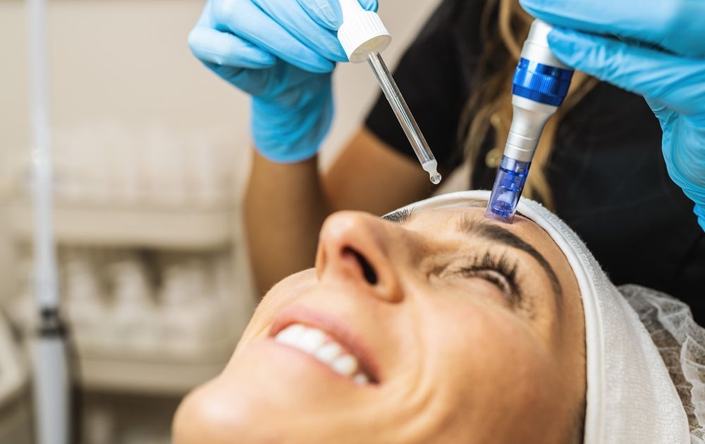 Woman receiving microneedling treatment. Blue gloved hands use a device on her forehead. She smiles, eyes up.
