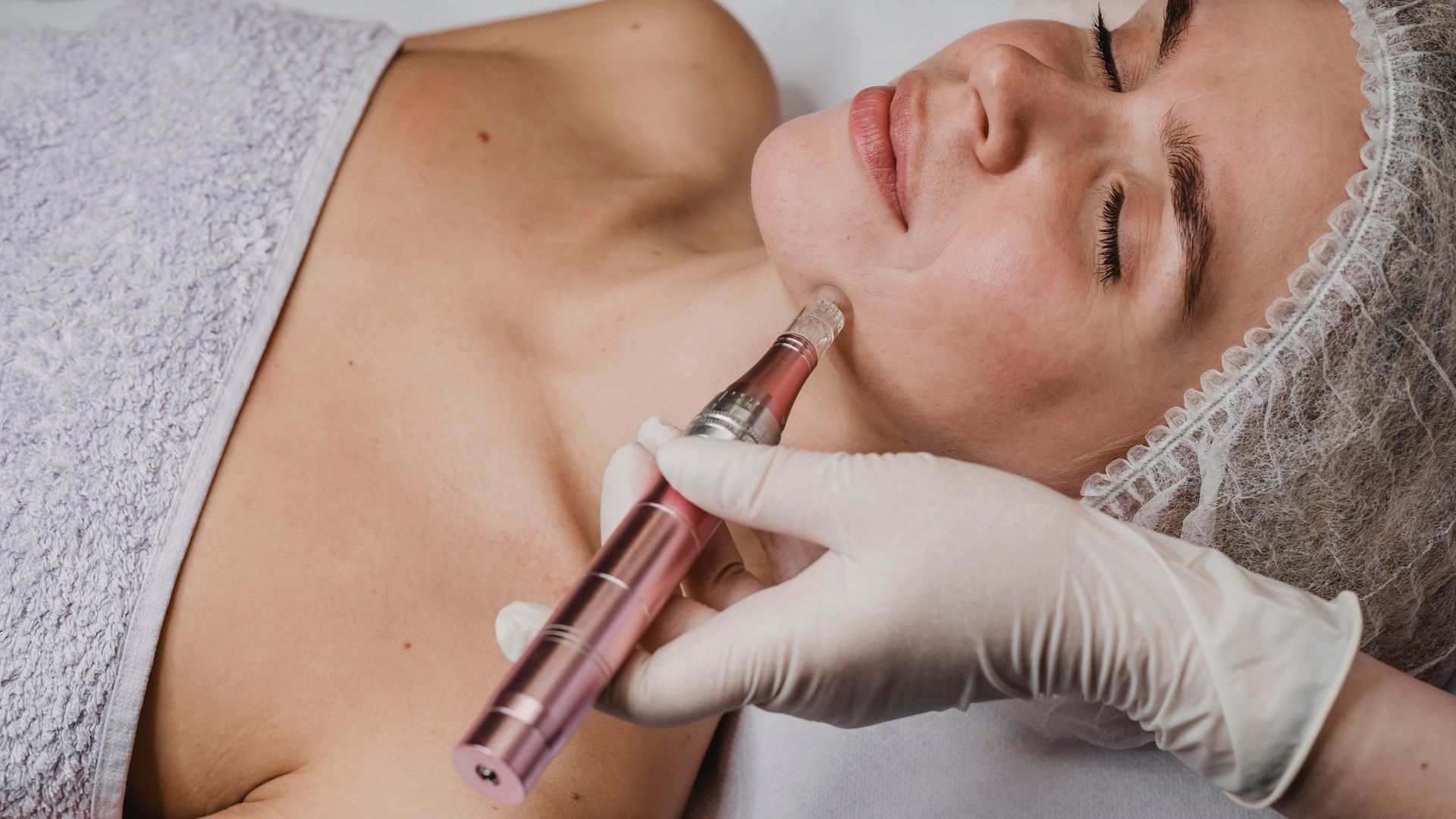 A gloved hand uses a pink microneedling pen on a client's jawline during a professional skincare treatment.