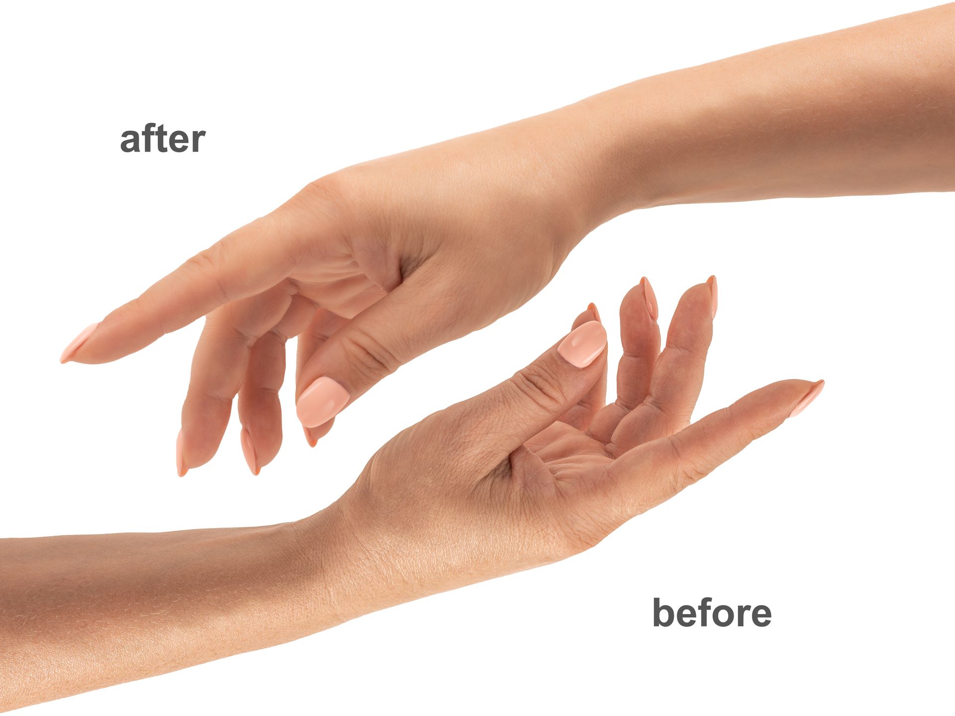 Comparison showing a dry, textured hand labeled 