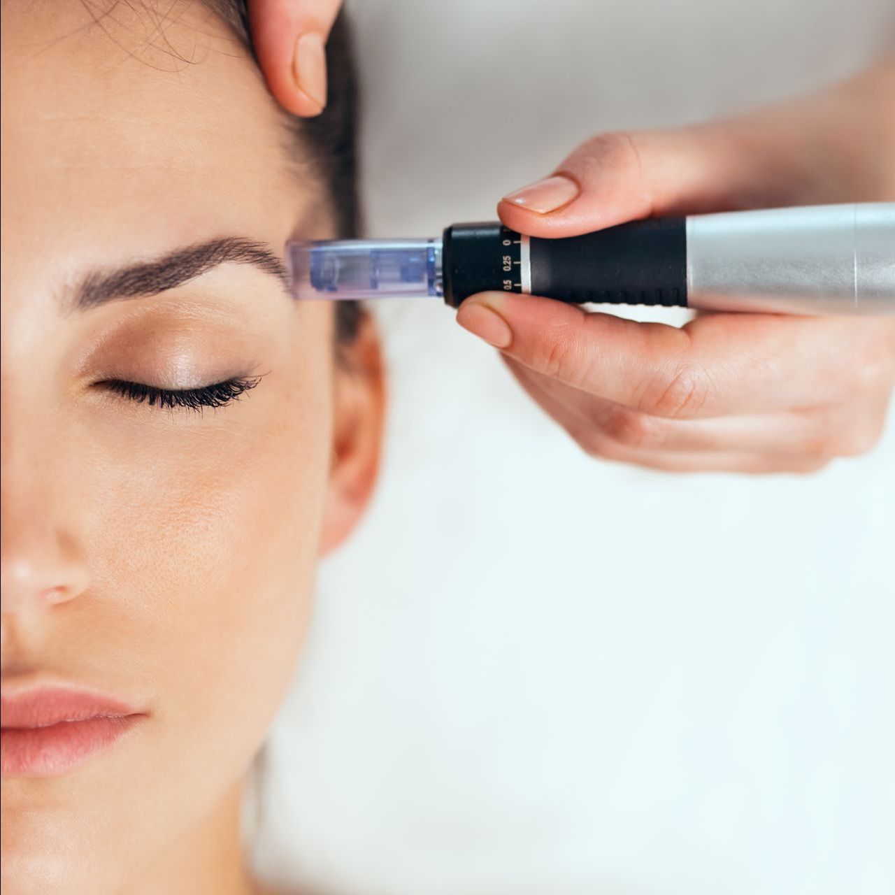 A woman is getting a microneedle treatment on her forehead.