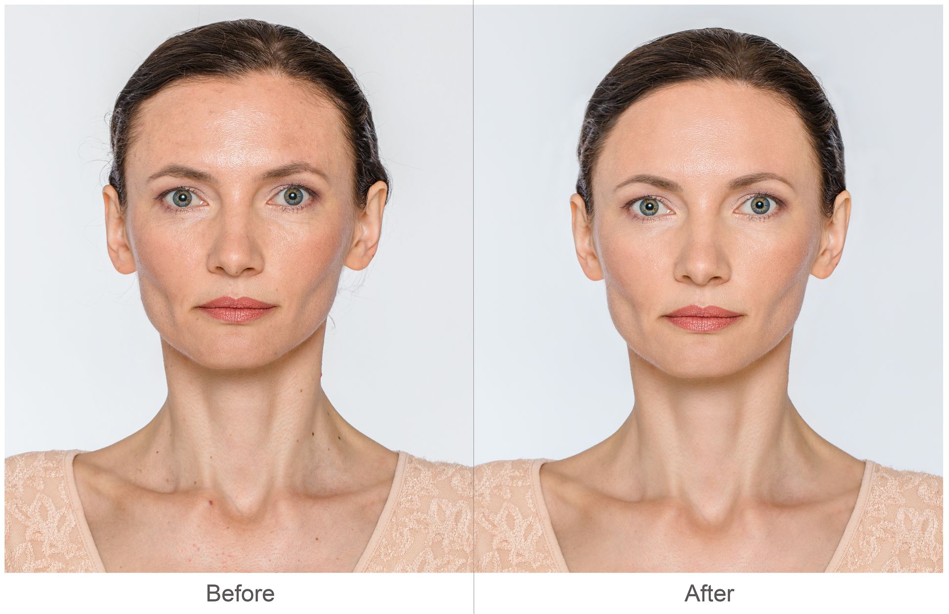 A before and after photo of a woman 's face.
